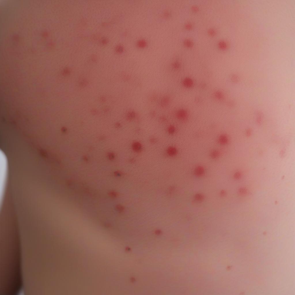 Ban đỏ trên da của bệnh sởi rubella